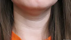 Îți trădează vârsta imediat: cum să scapi de „cercurile lui Venus” de pe gât